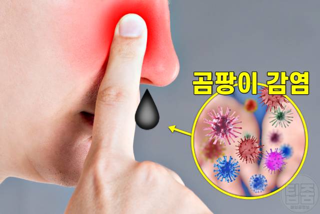 콧물 색깔별 증상,검은색 콧물 색깔로 보는 건강