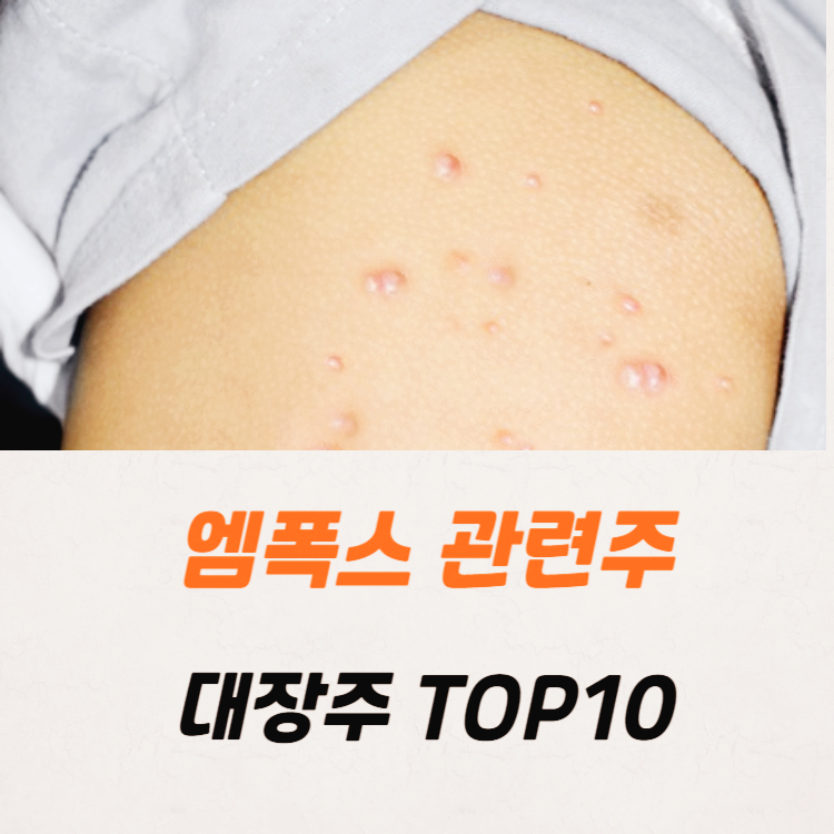 엠폭스 관련주 대장주 TOP10 : 원숭이두창
