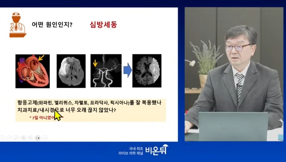 방오영-교수-경동맥이위험하다-뇌졸중