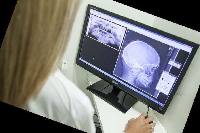 잇몸 내려앉음 치료