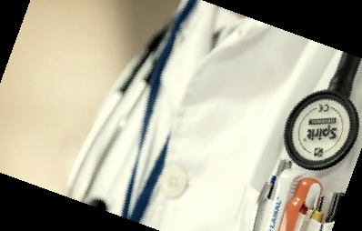 피똥사는 이유 대장암