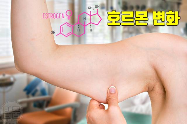 부위별 살찌는 이유 승마살 팔뚝살 뱃살 옆구리살 등살