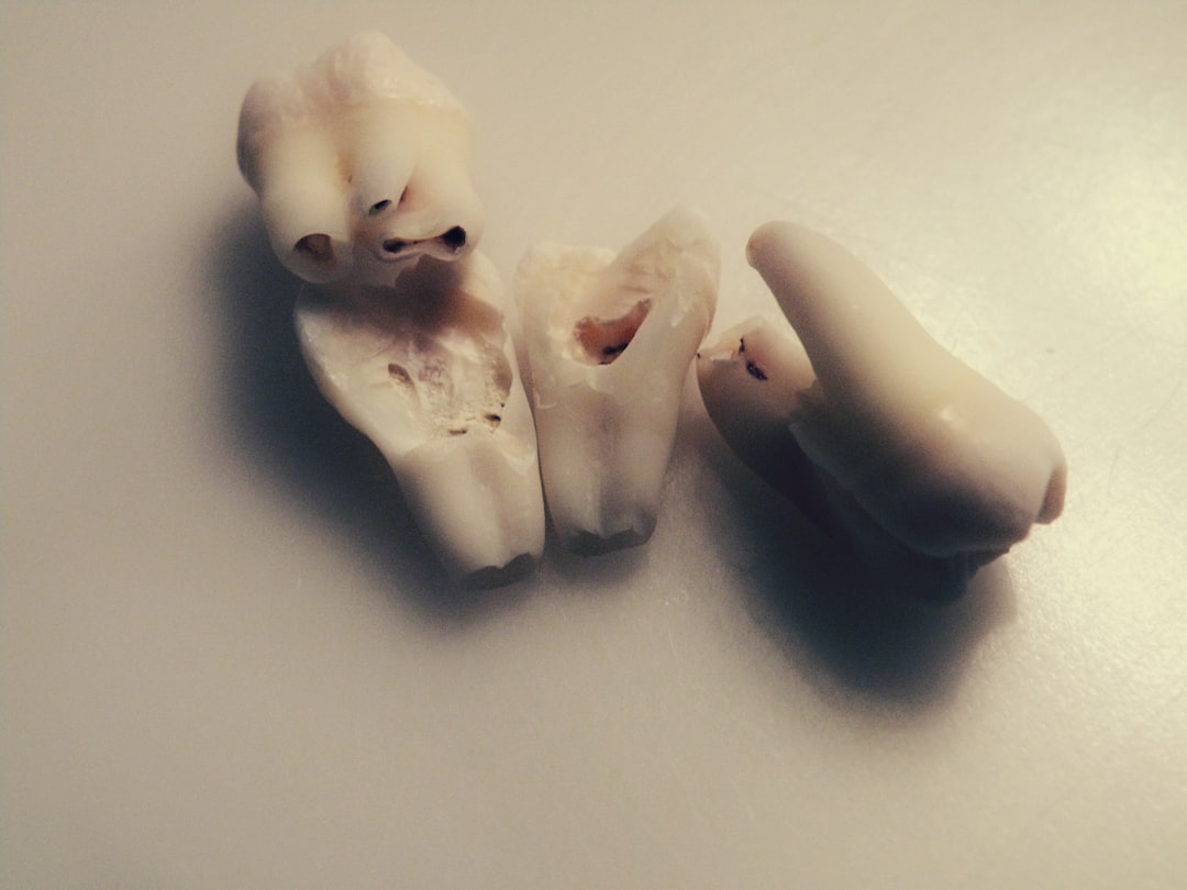 Wisdom tooth.