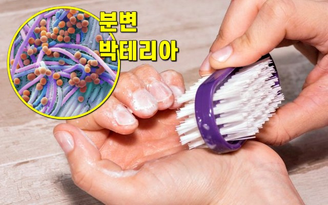 손톱 밑 세균 의사쌤