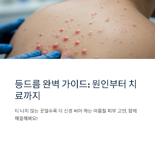 등드름 원인부터 치료까지, 깨끗한 등 피부를 위한 완벽 가이드