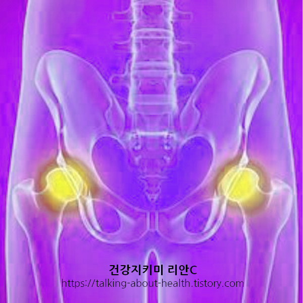 고관절 부위 중요한 이유 및 고관절 통증 시 좋은 운동 방법