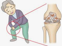 무릅 건강 관절 건강 콘드로이친