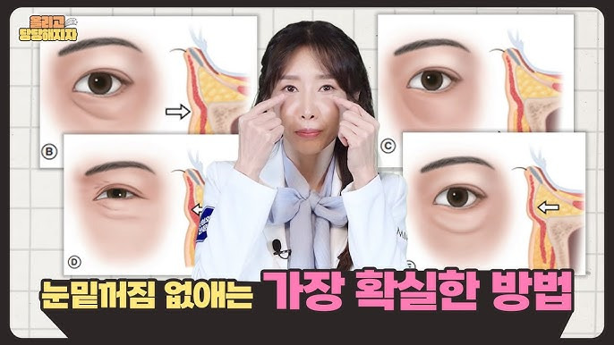 눈밑꺼짐-없애는법:-젊고- 생기- 있는- 눈