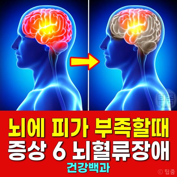 뇌에 피가 부족할때 증상 피가부족한증상 뇌혈류장애