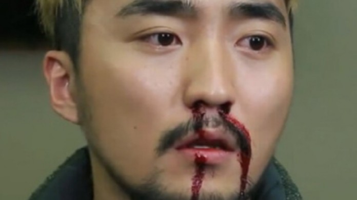 코피가-멈추지-않을때