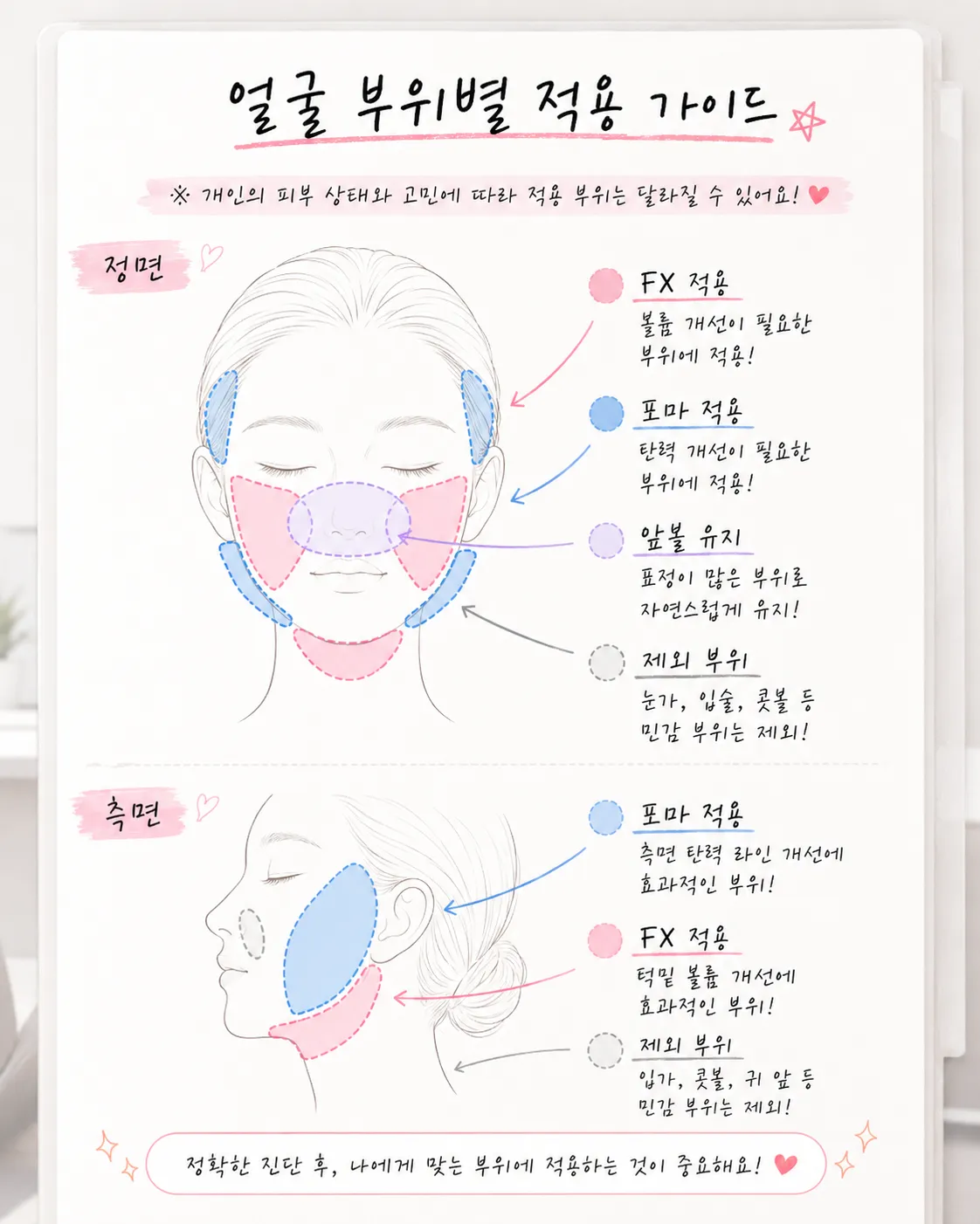 인모드 샷 수보다 시술 부위를 확인하는 방법