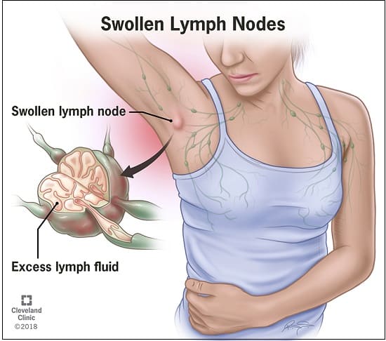 면역 체계의 모든 것 Immune System