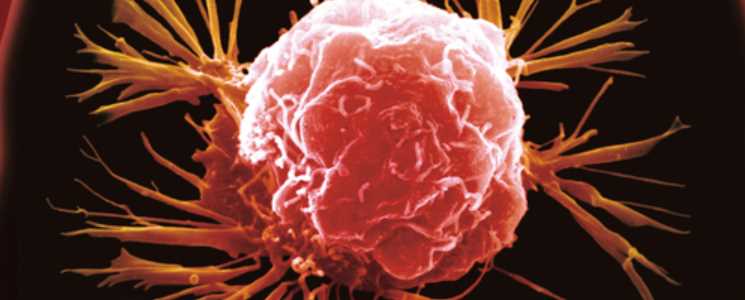 우엉 효능 - 특정 암 예방