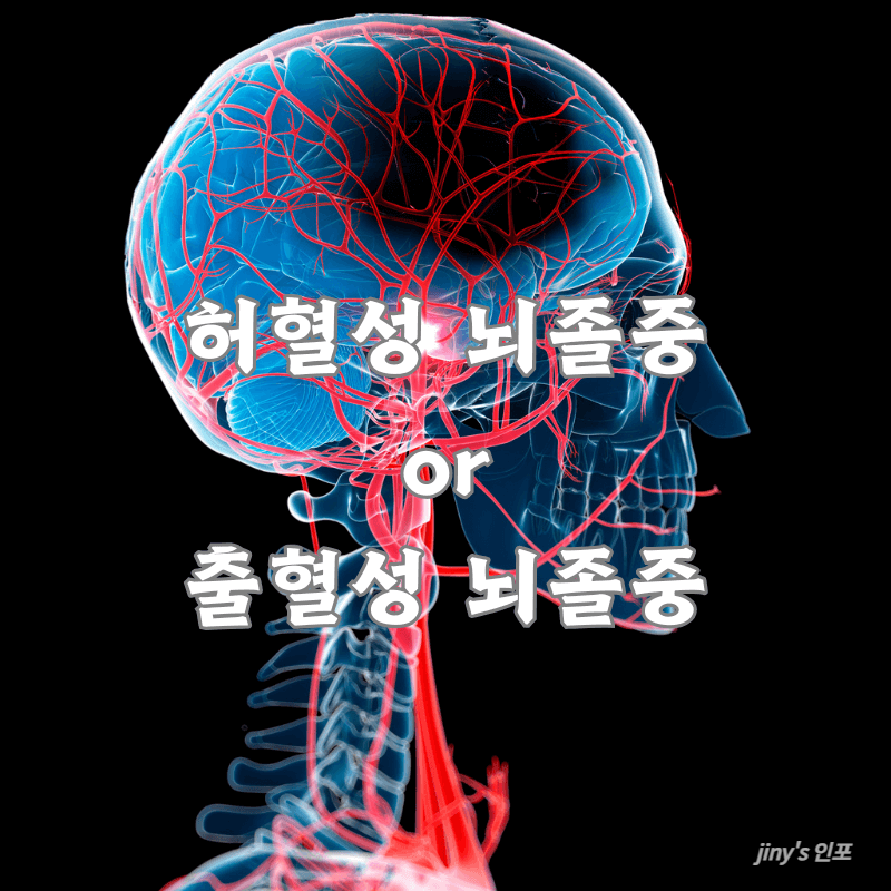 뇌졸중
