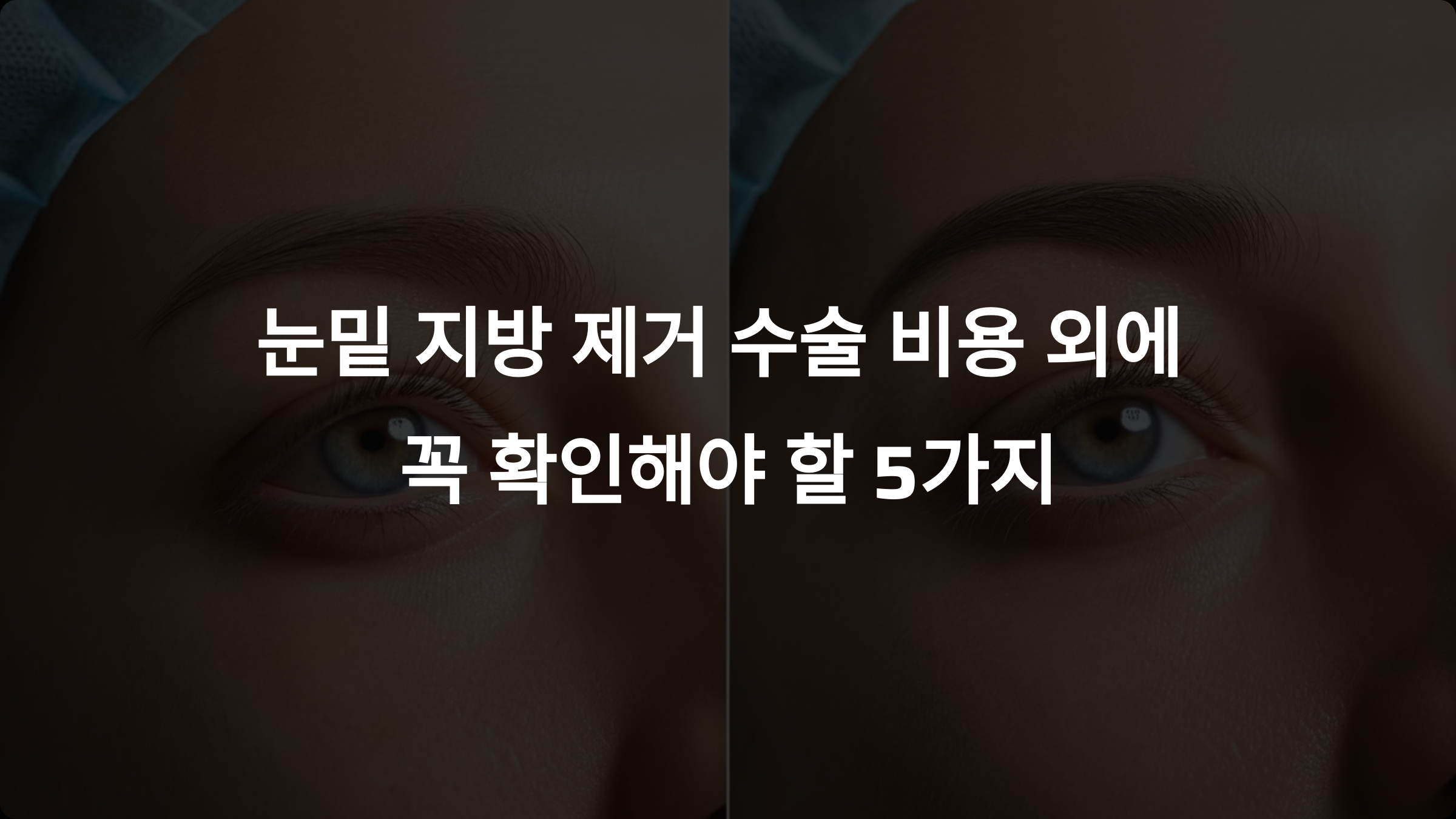 눈밑 지방 제거 수술: 비용 외에 꼭 확인해야 할 5가지