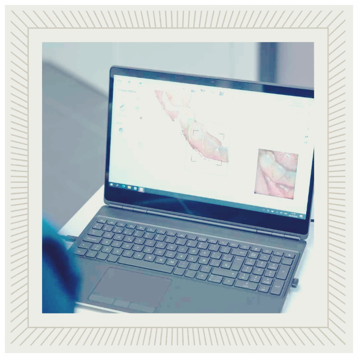 치과 임플란트 건강보험적용가격