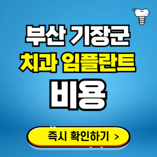부산 기장군 임플란트 가격 비용 조회하기 ❘ 내 근처 저렴한 치과 찾기