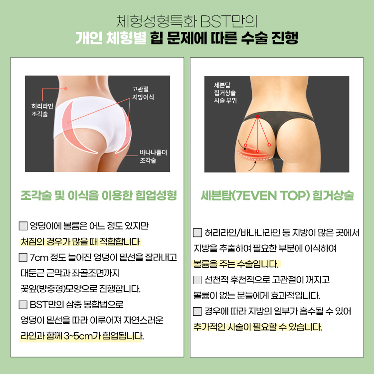 개인 체형별 힙 문제에 따른 수술 진행
조각술 및 이식을 이용한 힙업성형
세븐탑 힙거상술