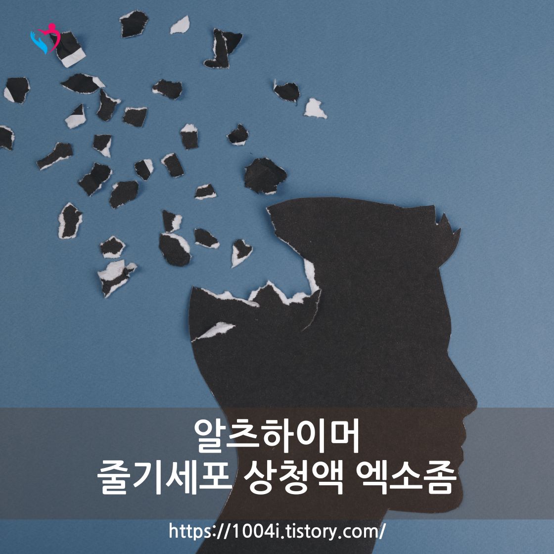 알츠하이머성 치매 뇌 신경 질환
