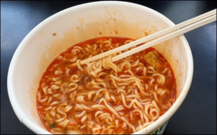 손이 붓는 이유-5