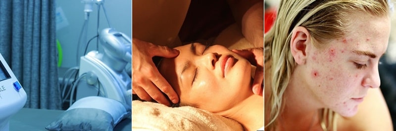 미세 박피술 과정과 부작용