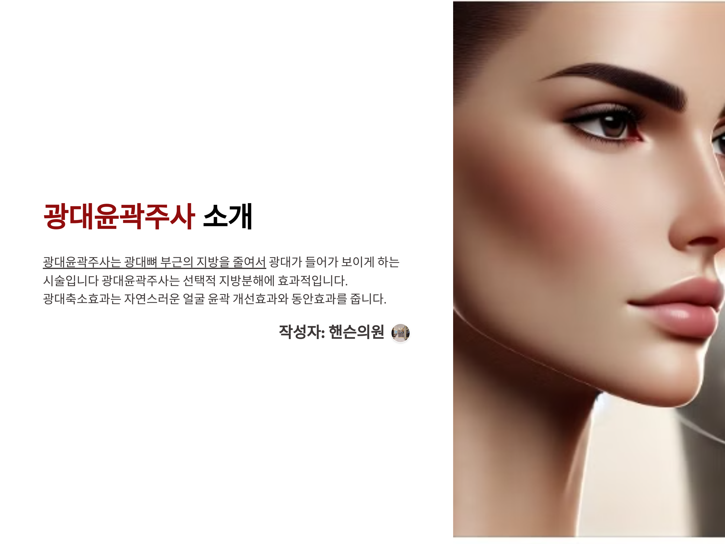 옆광대축소주사