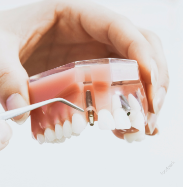 라미네이트 부작용