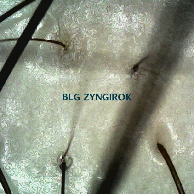 탈모 극복 프로젝트 - 정수리와 이마 사이 두피 모습이다.