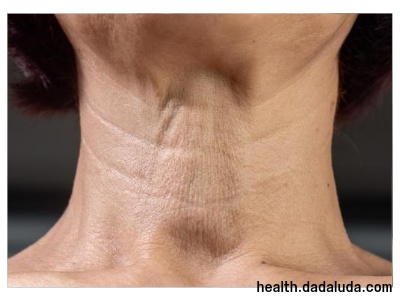 목주름 관리 하는법