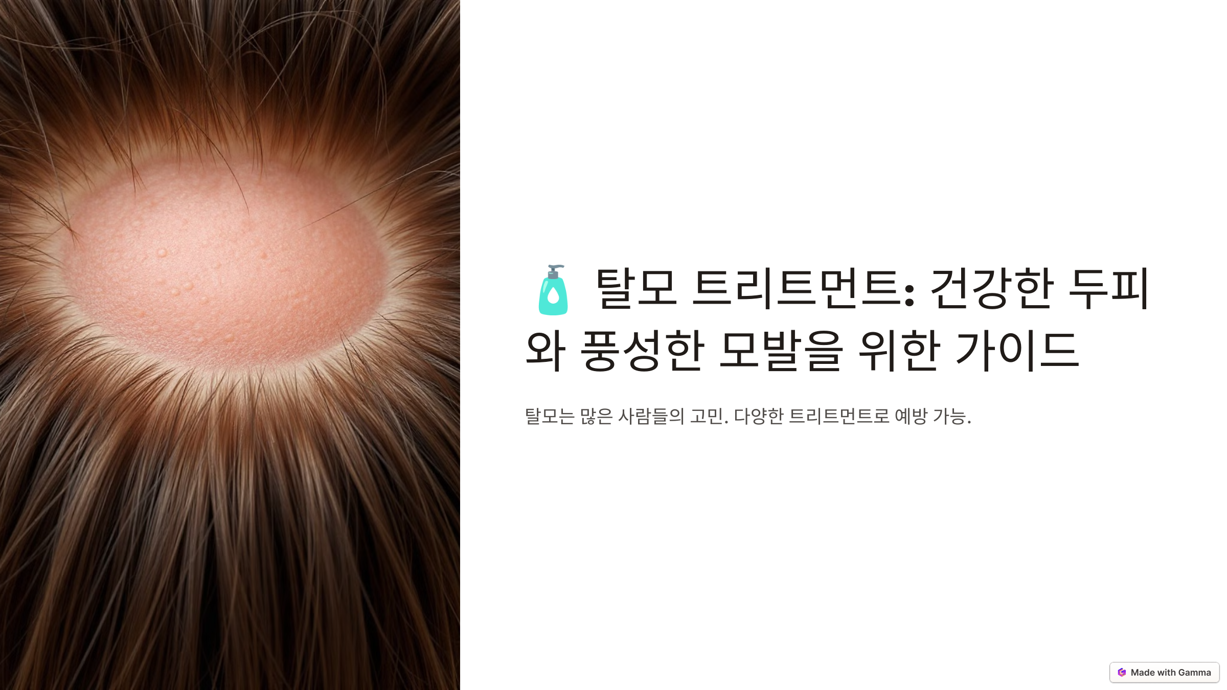 탈모 트리트먼트: 건강한 두피와 풍성한 모발을 위한 가이드