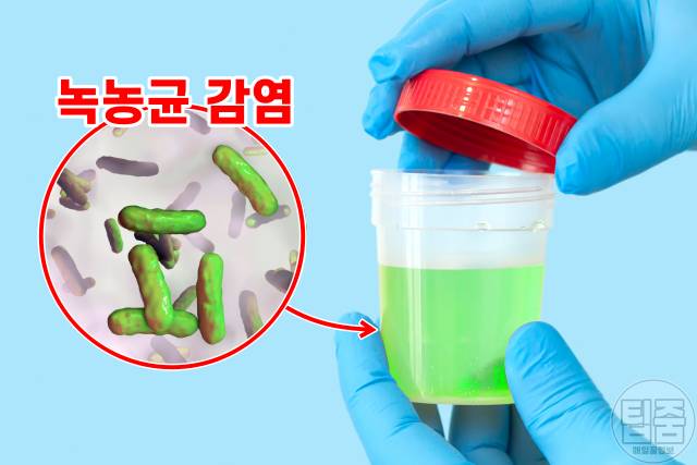 소변색깔 건강상태,연두색 파란색,소변색깔이 뿌옇다