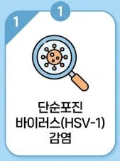 입술 포진 빨리낫는법