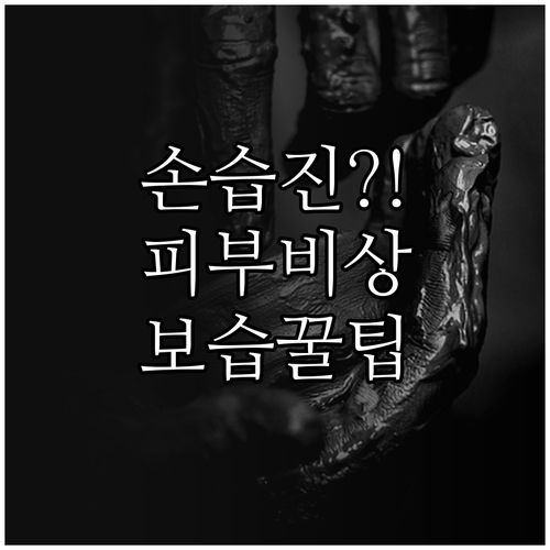 환절기 손 습진 예방 방법과 올바른 ..