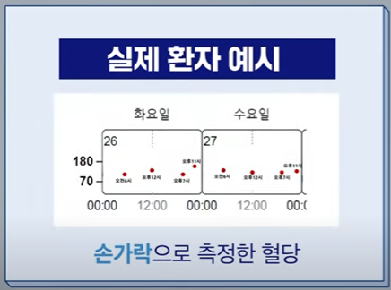 연속혈당측정기