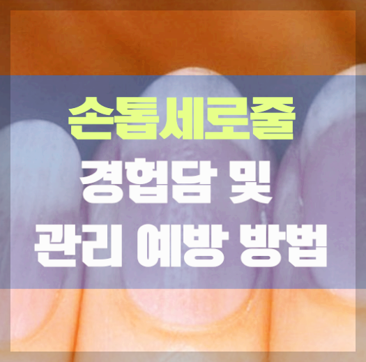 손톱 세로줄 경험담과 원인, 대처법, 관리