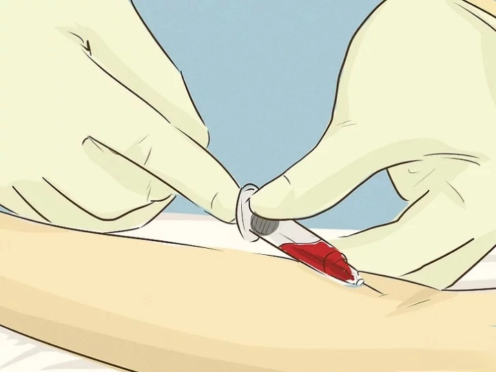 뎅기열 예방접종 증상 전염경로 치료방법 위험국가