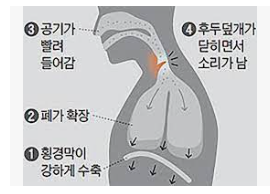 딸국질이란? 원인, 이유