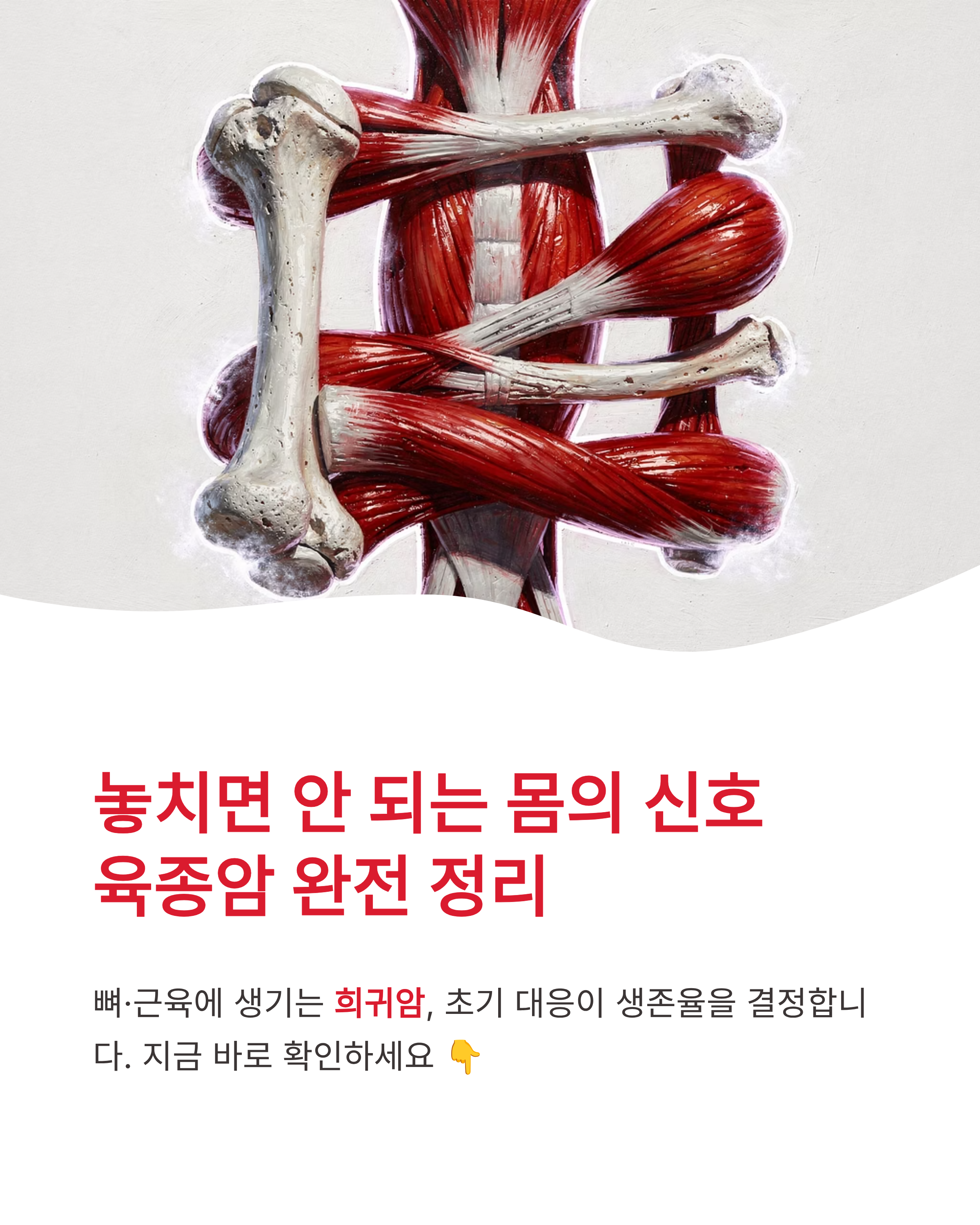 육종암 증상과 초기증상 및 생존율 총정리, 놓치면 안 되는 몸의 신호는?