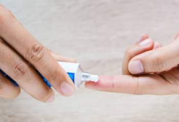 화농성 한선염 연고