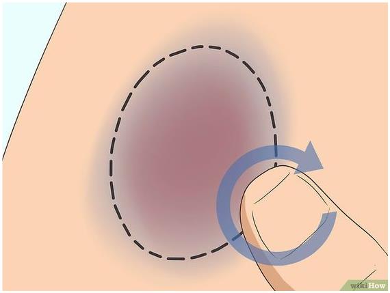 멍에 바라는 약 사용법