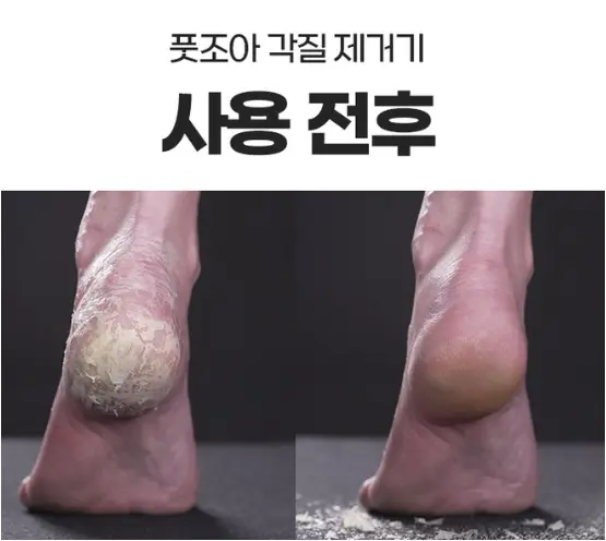 풋조아 FOOTJOA 전동 발 각질 제거기