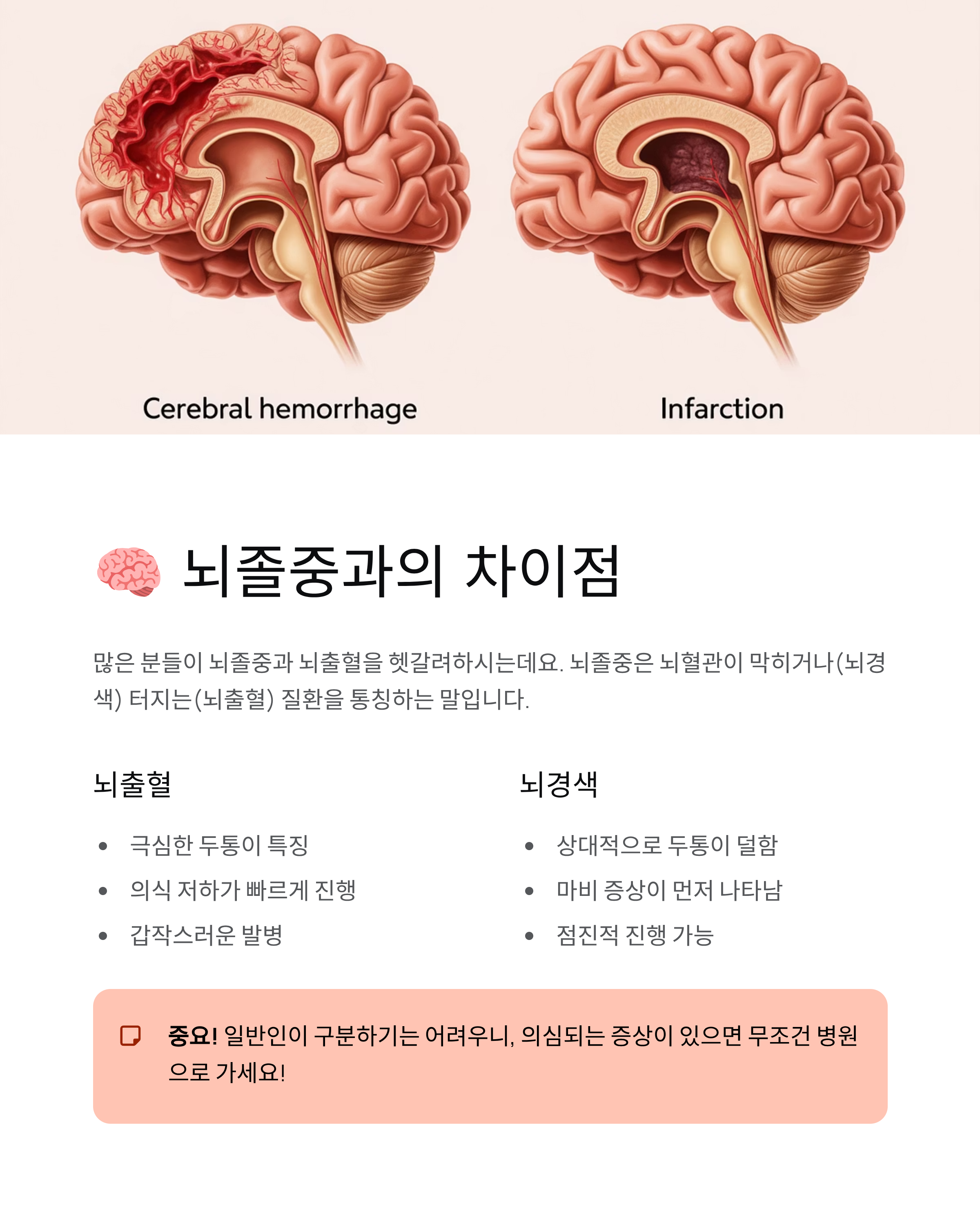 뇌출혈 전조증상 완벽 가이드 - 골든타임을 놓치지 마세요!
