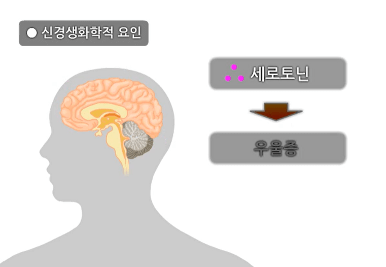 우울증의 생물학적 요인2