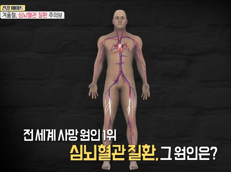 EBS-명의-심뇌혈관질환-오성진-교수