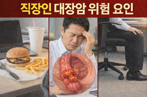 직장인 대장암 위험 요인 (식습관, 스트레스, 장시간 앉기)