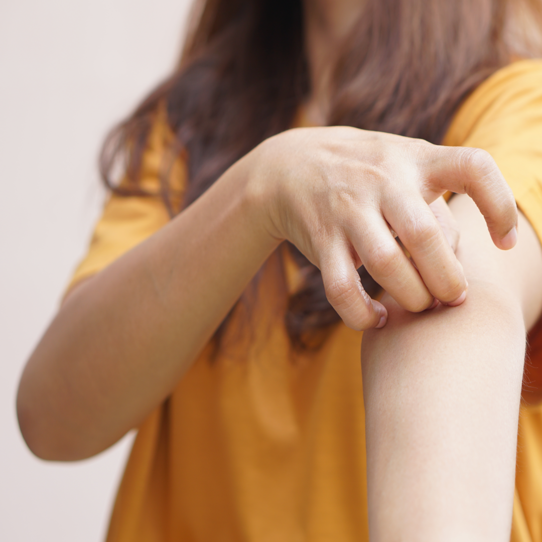 알레르기 예방 관리 관련 사진