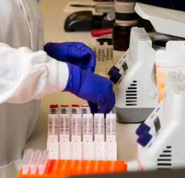 갑상선 기능 저하증 완치하는 법 진단 기준