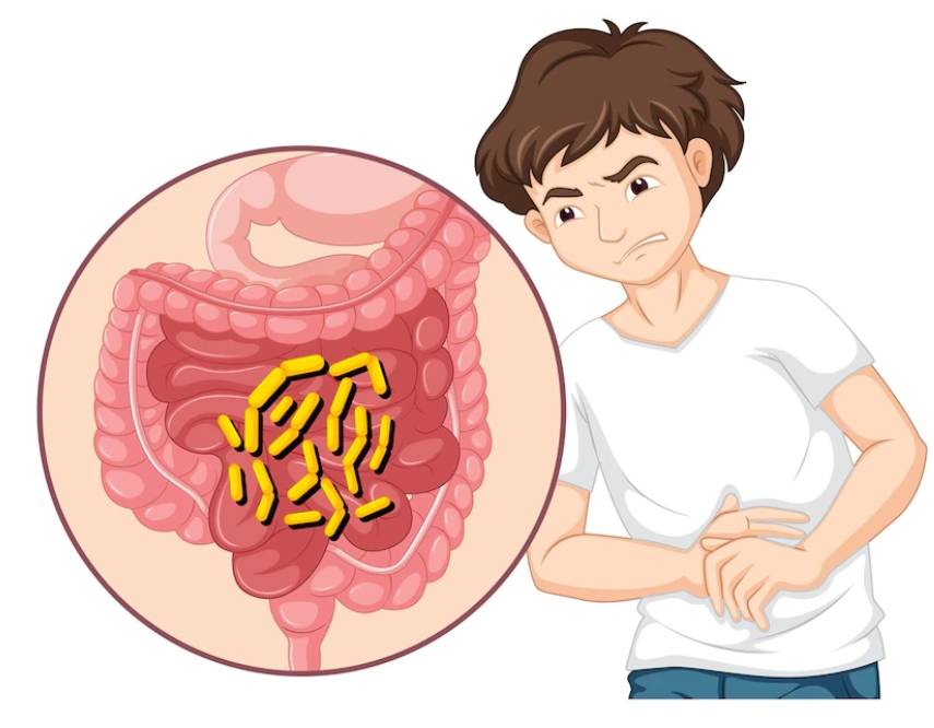 설사를 유발하는 세균이 장 내에 있는 모