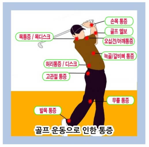 골프와 부상부위