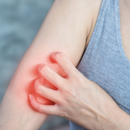 건선, 평생을 함께하는 만성 염증 질환